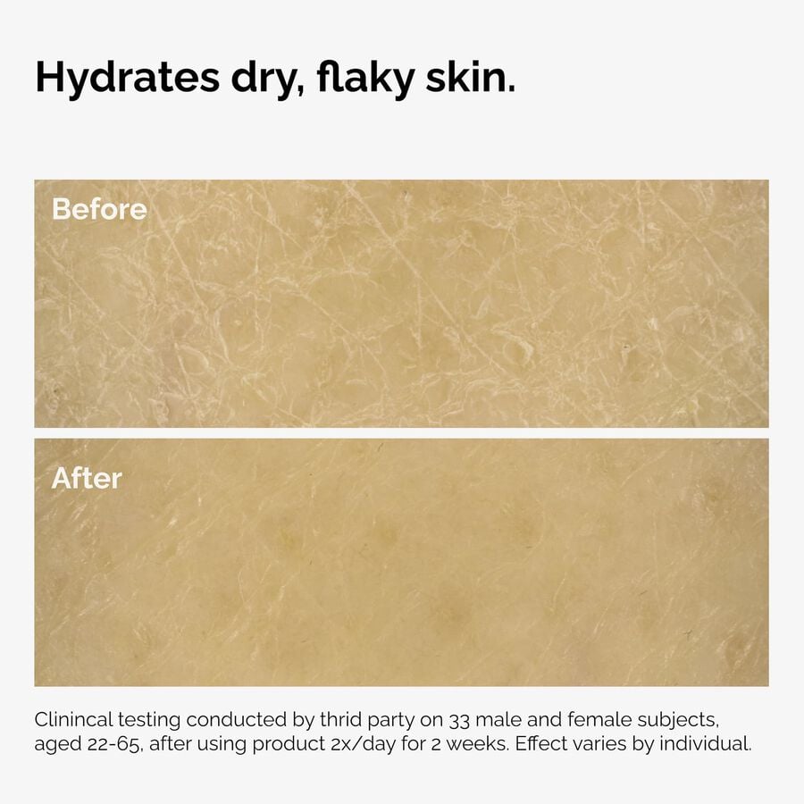 the-body-care-collection-x5 ord-natural-moisturizing-factors-inulin-body-before-after-graphic-02.jpg