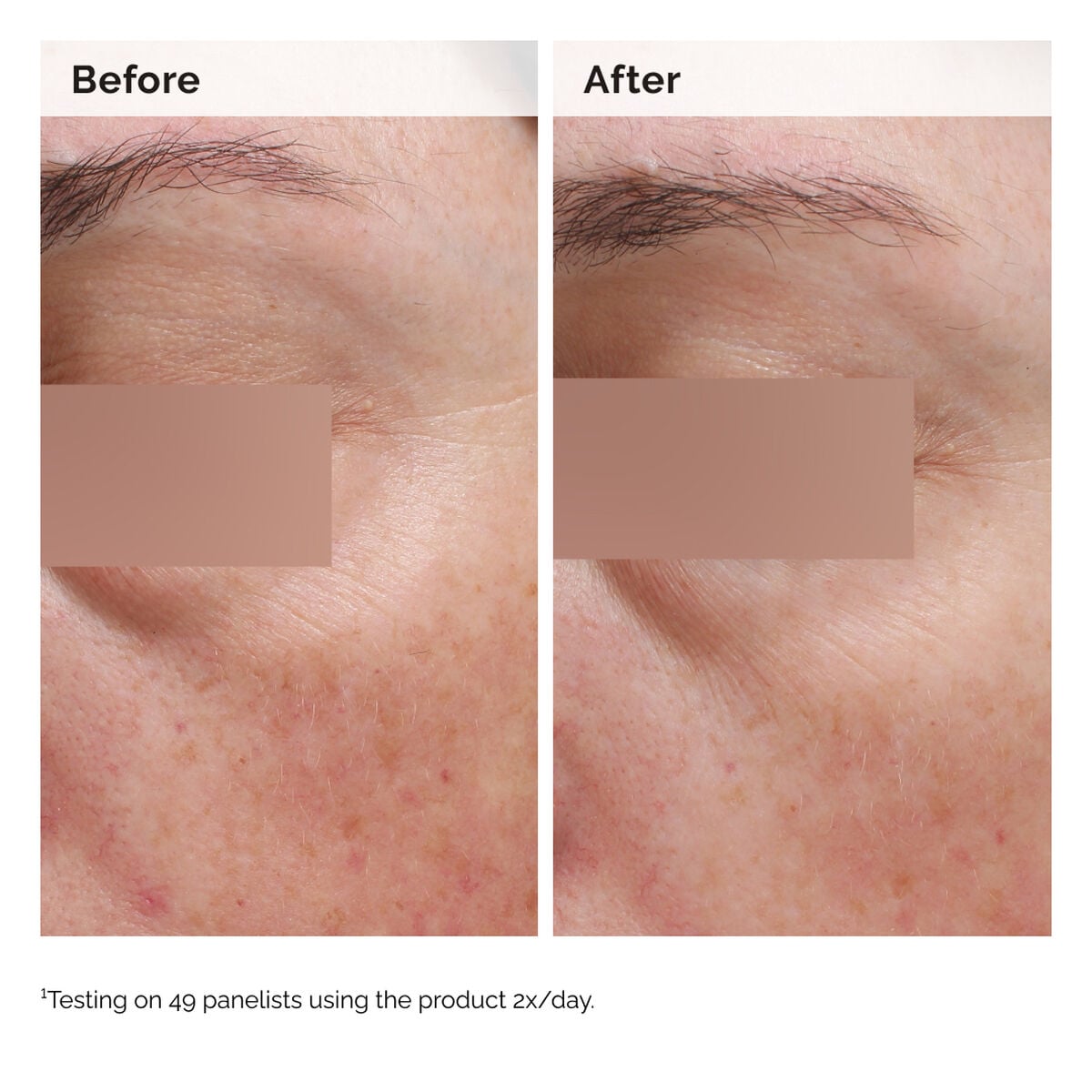 niacinamide-5-face-and-body-emulsion-t6 2024-08-23-ORD-Nia-5pct-Face-Body-B-A-Elasticity-Global-02-1x1.jpg