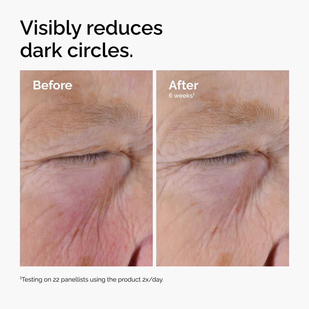 caffeine-solution-5-egcg-eye-serum-g6 ord-caffeine-solution-egcg-dark-circles-before-after.jpg