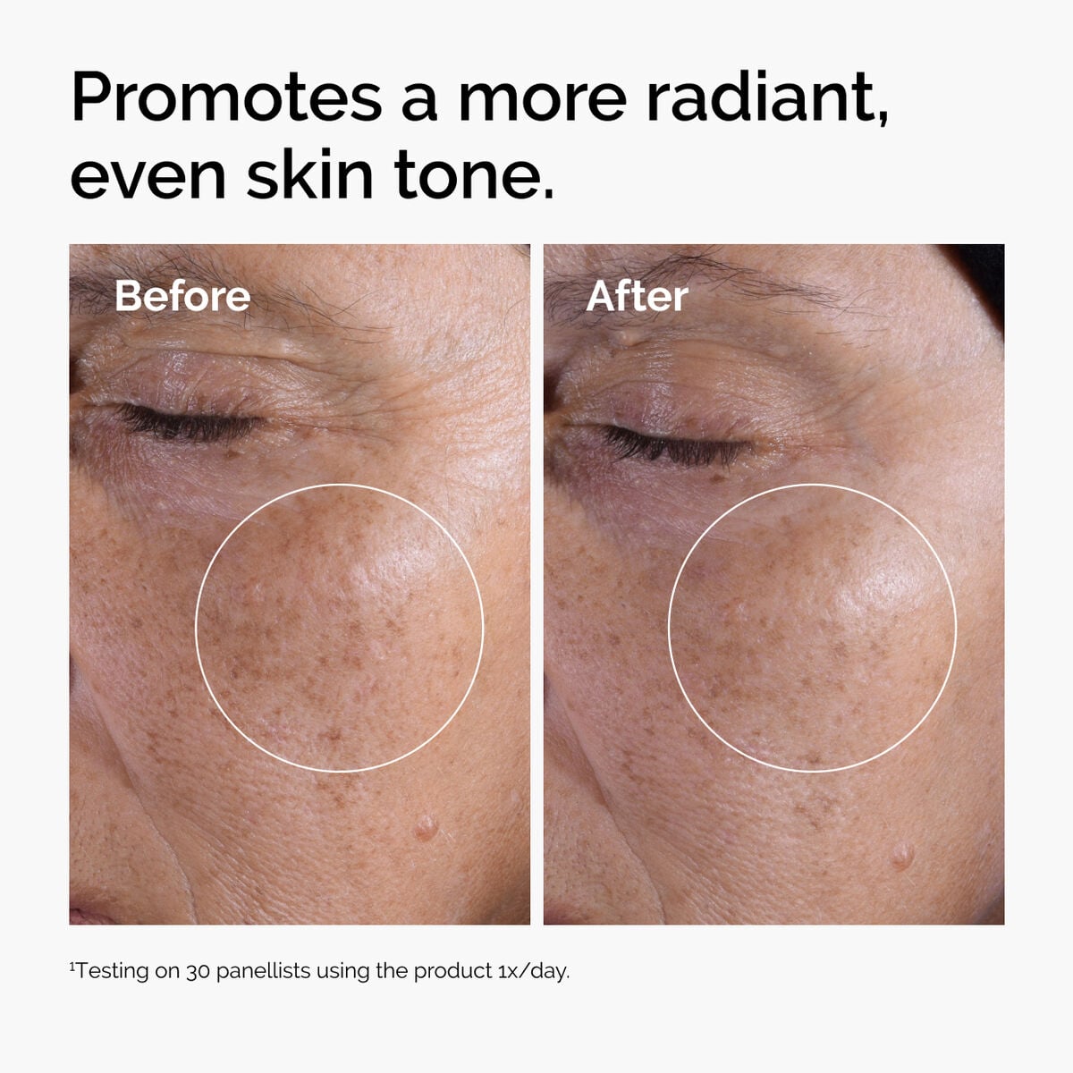 glycolic-acid-7-exfoliating-toner-m4 ord-glycolic-before-after-radiance.jpg