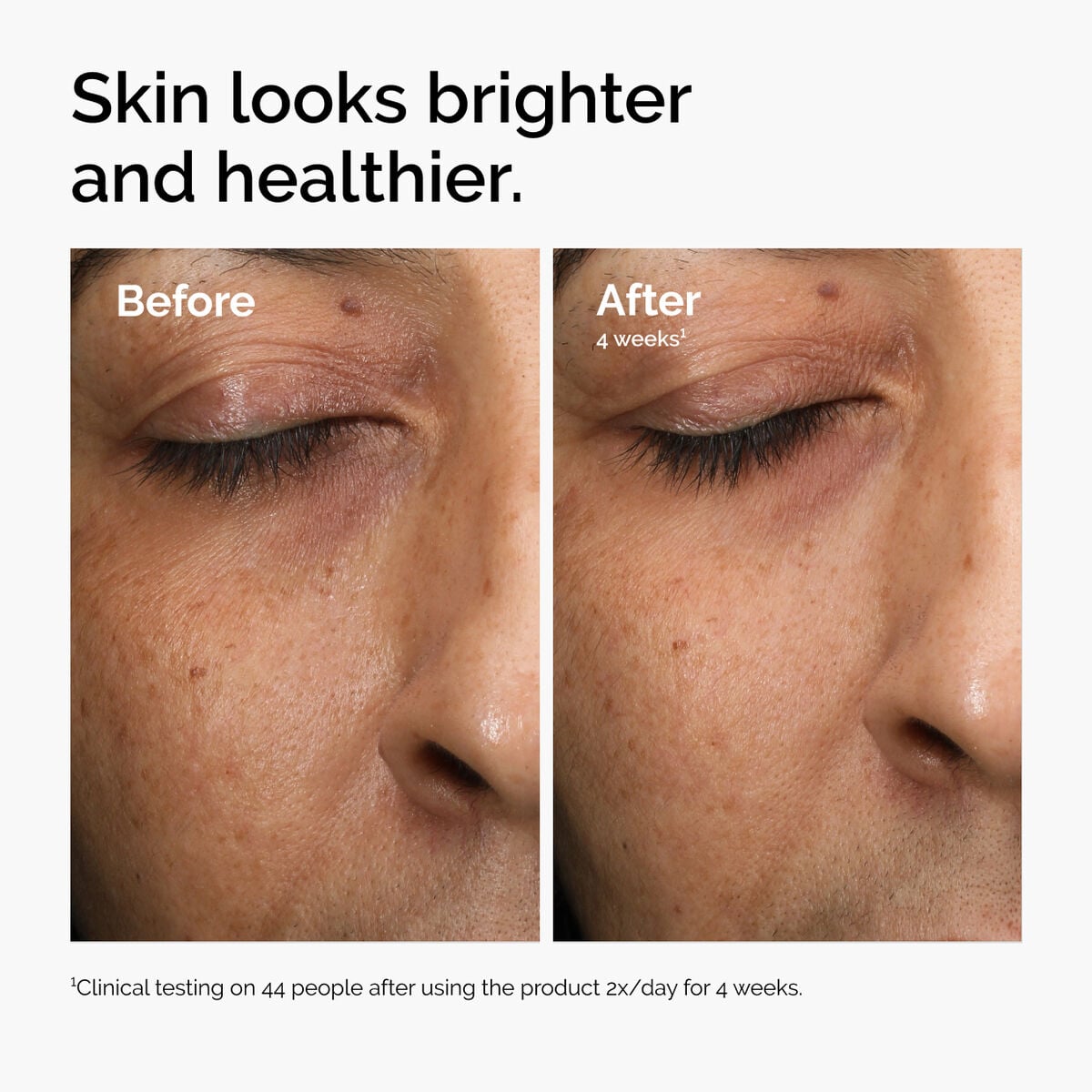 multi-antioxidant-radiance-serum-g0 ord-mars-before-after-healthy.jpg