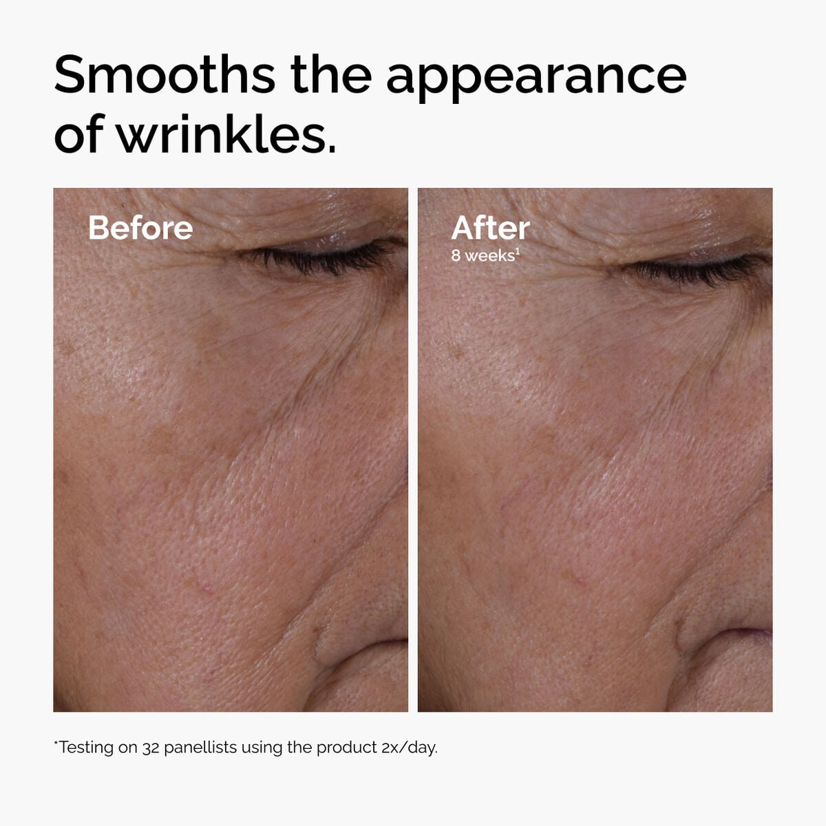 multi-peptide-ha-serum-u7 ord-multi-peptide-ha-serum-wrinkles-before-after.jpg