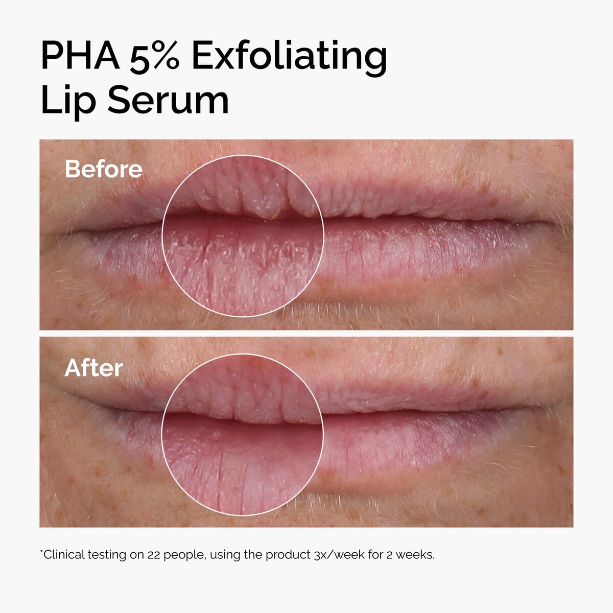 pha-5-exfoliating-lip-serum-h3 ord-pha-5pct-lip-exfoliating-serum-before-after.jpg