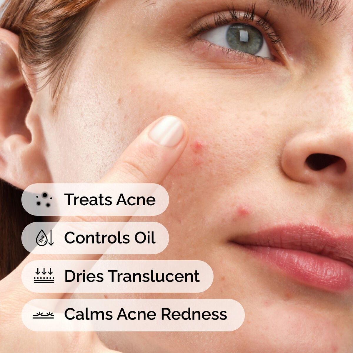 sulfur-10-powder-to-cream-concentrate-s1 ord-sulfur-10pct-powder-to-cream-concentrate-model-application-with-benefits-acne.jpg